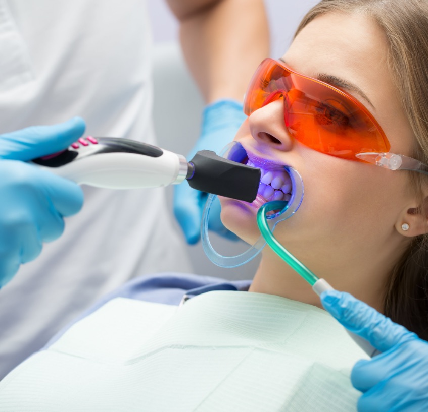 terapie-laser-assistite Отбеливание зубов