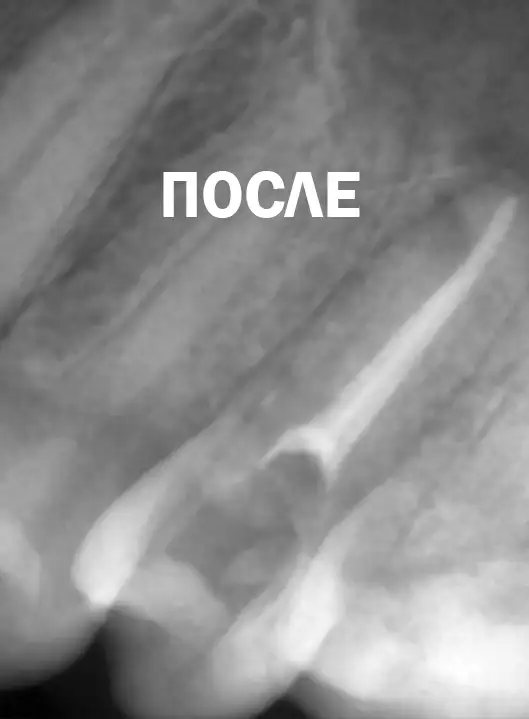 posle Портфолио